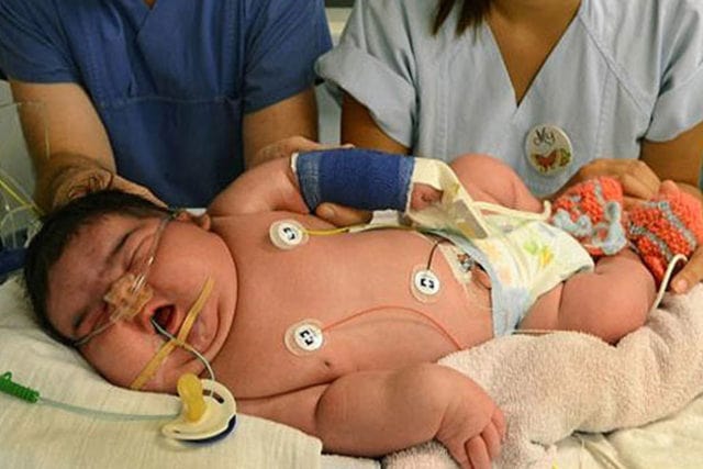 Dünyanın En Kilolu Doğan Bebeği Bakın Kaç Kilo Doğmuş!